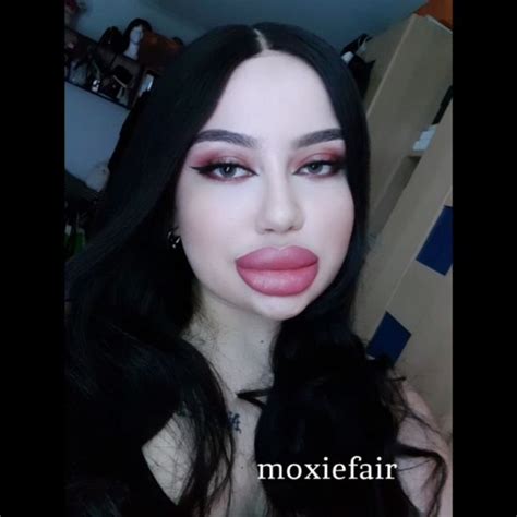 pin by doll girl on quick saves big lips fake lips lip injections