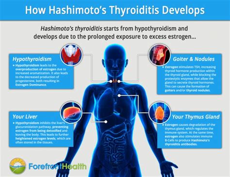 Pin On Thyroid