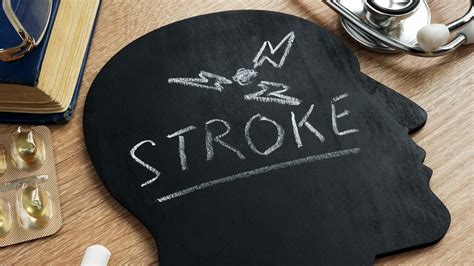 Stroke Mortality Down But Global Burden Remains High