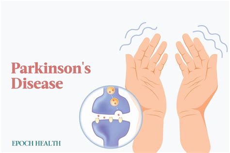 The Essential Guide To Parkinsons Disease Symptoms Causes