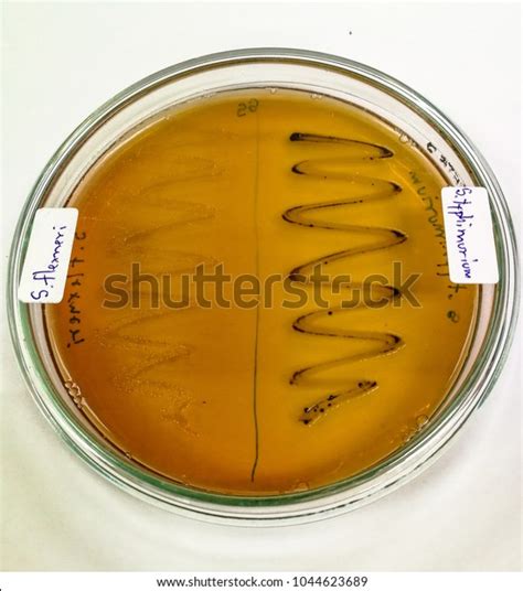 Salmonella shigella (ss) agar is a modification of the desoxycholate citrate agar described by leifson. Shigella Flexneri Salmonella Typhimurium On Salmonella ...