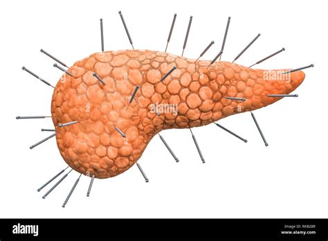 Human Pancreas With Acupuncture Needles Acupuncture Treatment Of