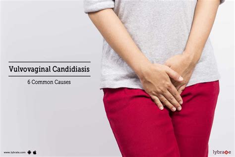 Vulvovaginal Candidiasis Common Causes By Dr Krity K Uniyal