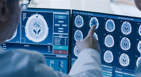 Another name for an interventional study. New immunotherapy vaccine for glioblastoma tested at ...