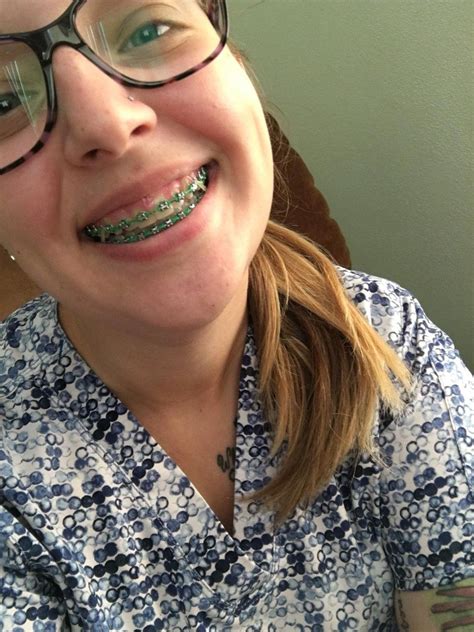 Braces Girlswithbraces Metalbraces Glasses Glassesandbraces Girlswithglasses Braces