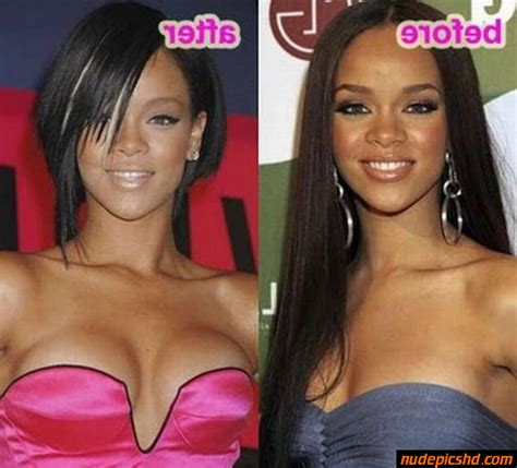 Rihanna Plastic Surgery Before After Nude Leaked Porn Photo Nudepicshd Com