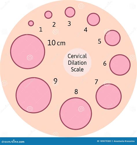 cervical dilation chart printable