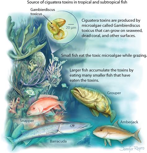 Ciguatera Fish Poisoning Toxicology Jama Jama Network