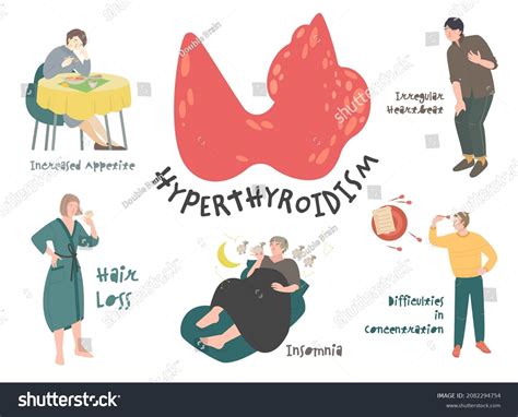 Hyperthyroidism Symptoms Infographic Thyroid Gland Dysfunction Stock