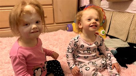 Conjoined Nc Twins Separated Hospital Says Theyre Healthy Durham Herald Sun