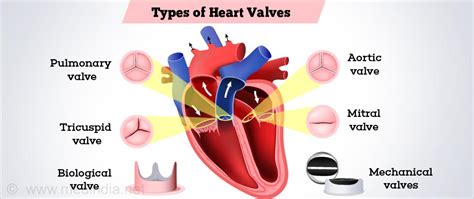 Prosthetic Heart Valves Symptoms Types Advantanges Disadvantages