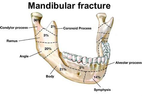 Acidentes Anatomicos Da Mandibula