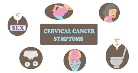 10 Warning Signs Of Cervical Cancer You Should Not Ignore Page 4 Of