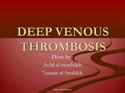 Ppt Deep Venous Thrombosis Powerpoint Presentation Free Download