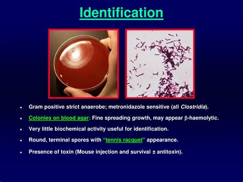 Ppt Gram Positive Bacilli Of Medical Importance Powerpoint