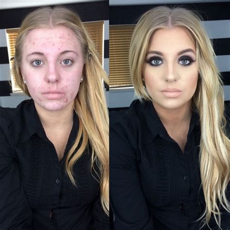 This Woman's Before-and-After Photo Became a Nasty Internet Meme, and
