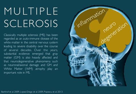 Multiple Sclerosis Introduction To Multiple Sclerosis