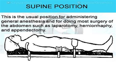Download Free Medical Surgical Positions Powerpoint Presentation