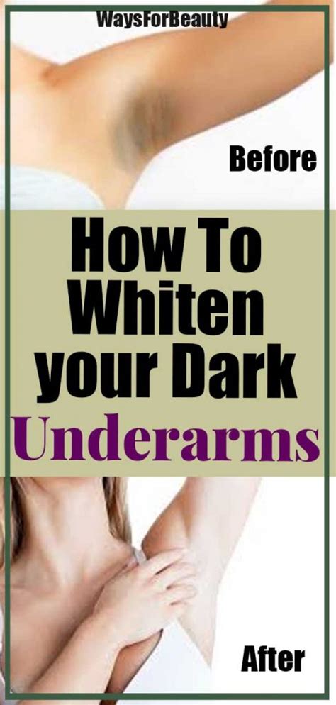Lemon juice lemon juice has similar whitening benefits as apple cider vinegar. How To Easy Way to Whiten your Dark Underarms at Home ...