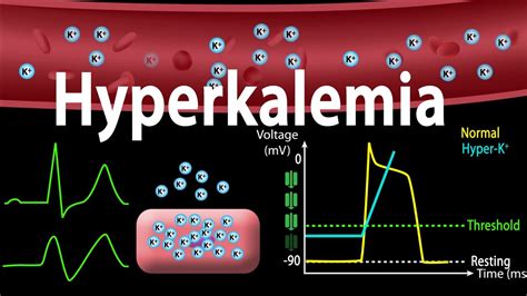 Hyperkalemia: Causes, Effects on the Heart, Pathophysiology, Treatment