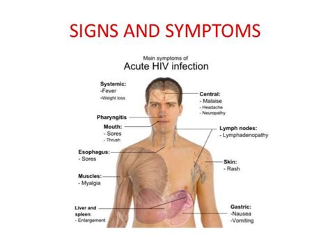 Aids A Secondary Immunodeficiency Disorder