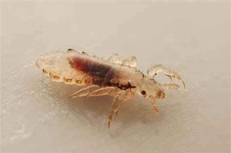 Head Lice Drug Appears To Stop Coronavirus—heres What You Need To Know