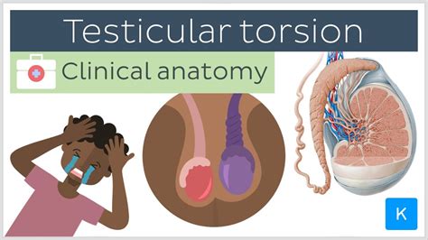 Testicular Torsion Treatment