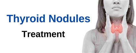 Thyroid Nodule Treatment Without Surgery Maven Medical Center
