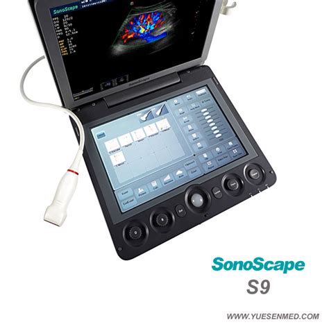 Portable D D Color Doppler Ultrasound Sonoscape S