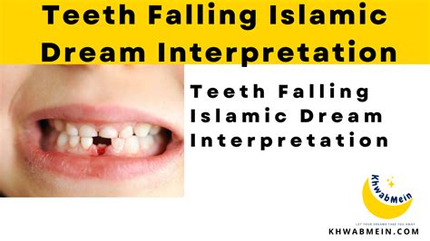 Teeth Falling Islamic Dream Interpretation And Its Symbolism