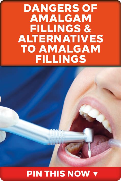 Are there risks in having mercury amalgam 'silver' fillings removed? The Dangers of Amalgam Fillings | Amalgam fillings ...