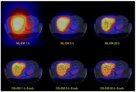 Biomedicines Free Full Text Personalized Dosimetry For Radionuclide