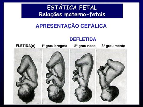 Apresentação Cefálica E Dorso à Esquerda