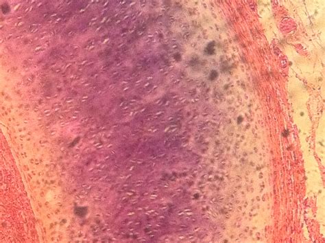 Hyaline Cartilage Histology