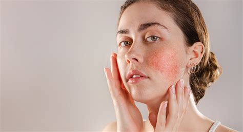 5 Types Of Skin Disorders And Best Possible Treatments