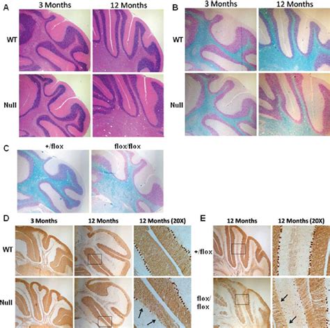 Median sagittal sections through the developing cerebellum, showing four different. Cerebellum histology. A : Overall cerebellum histology ...