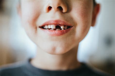 Boy Shows Off Missing Tooth Stock Photo Download Image Now Istock