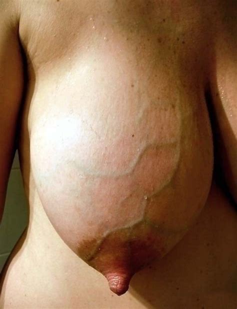 Big And Huge Natural Tits Nipples Saggy Chubby Puffy 42 Pics Xhamster