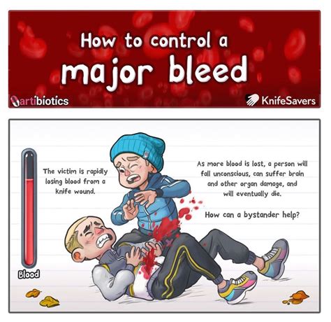brown journal of hospital medicine on twitter how to control a major bleed artibiotics bjhm