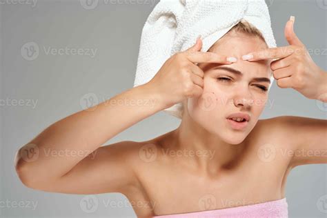 Woman With A Towel On Her Head Squeezes Pimples On Her Forehead Skin