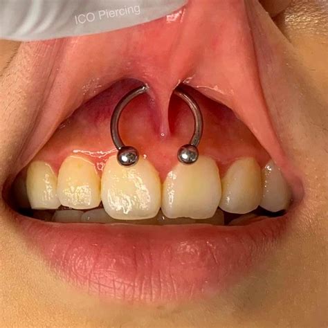 Smiley Piercing A Trending Body Modification 𝐁𝐞𝐬𝐭𝐫𝐚𝐭𝐞𝐝𝐬𝐭𝐲𝐥𝐞