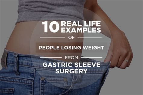 10 Real Life Weight Loss Examples From Gastric Sleeve Surgery