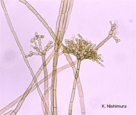 Fonsecaea compacta is a saprophytic fungal species found in the family herpotrichiellaceae. Fonsecaea compacta microscopy