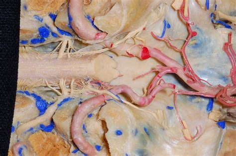 Neurovasculature Of Anterior Surface Of Posterior Cranial Fossa And