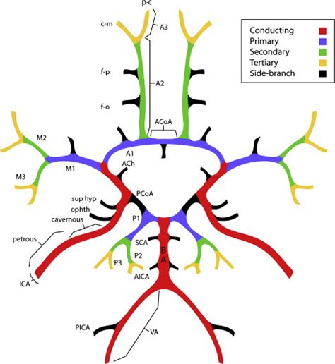 Cerebral Aneurysm Classification Based On Angioarchitecture Journal