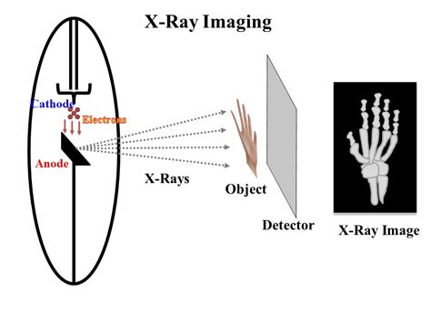X Ray Imaging What Are X Rays And How Are X Ray Images Taken