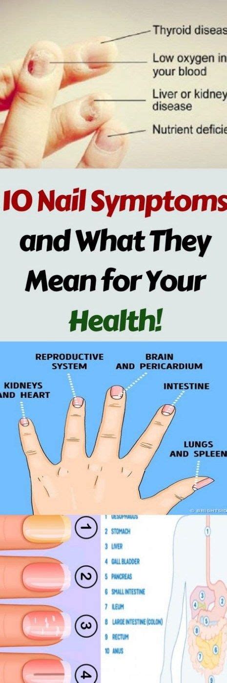 Here Are 10 Nail Symptoms And What They Mean For Your Health Explore