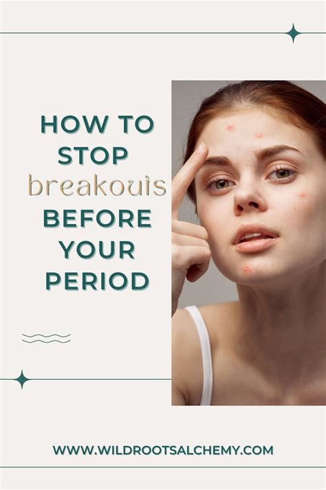 Premenstrual Acne Or Acne That Occurs Right Before Your Period Is So