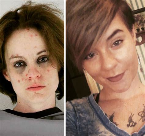 10 Stunning Before And After Transformations Of People Who Quit Drugs
