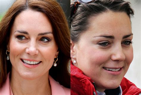 Foto Antes e depois de Kate Middleton surpreende por mudança nas